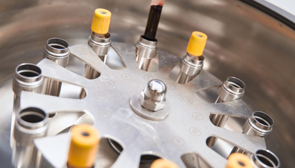 PRP PLASMA RICO EM PLAQUETAS