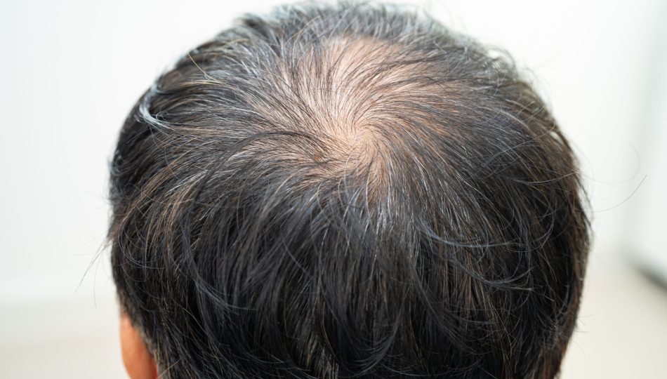 Bald in the middle head and begin no loss hair glabrous of mature Asian business smart active office man.